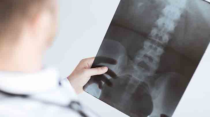 trajanje liječenja osteoartritisa jaka bol u ramenskom zglobu nego liječiti